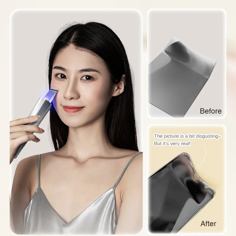 2-in-1 Ultrasonic Face Massager & Skin Scrubber