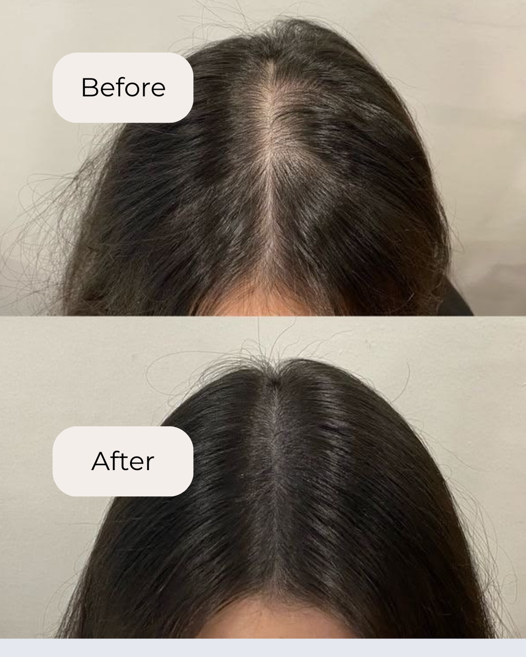 Rosemary & Ginger Scalp Oil
