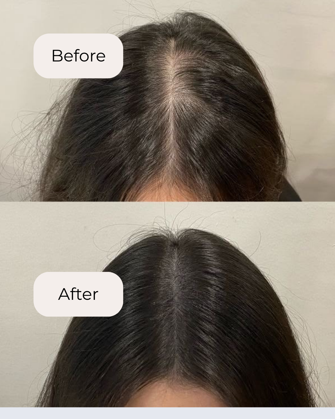 Rosemary & Ginger Scalp Oil