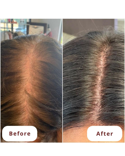 Brush Scalp Stimulation