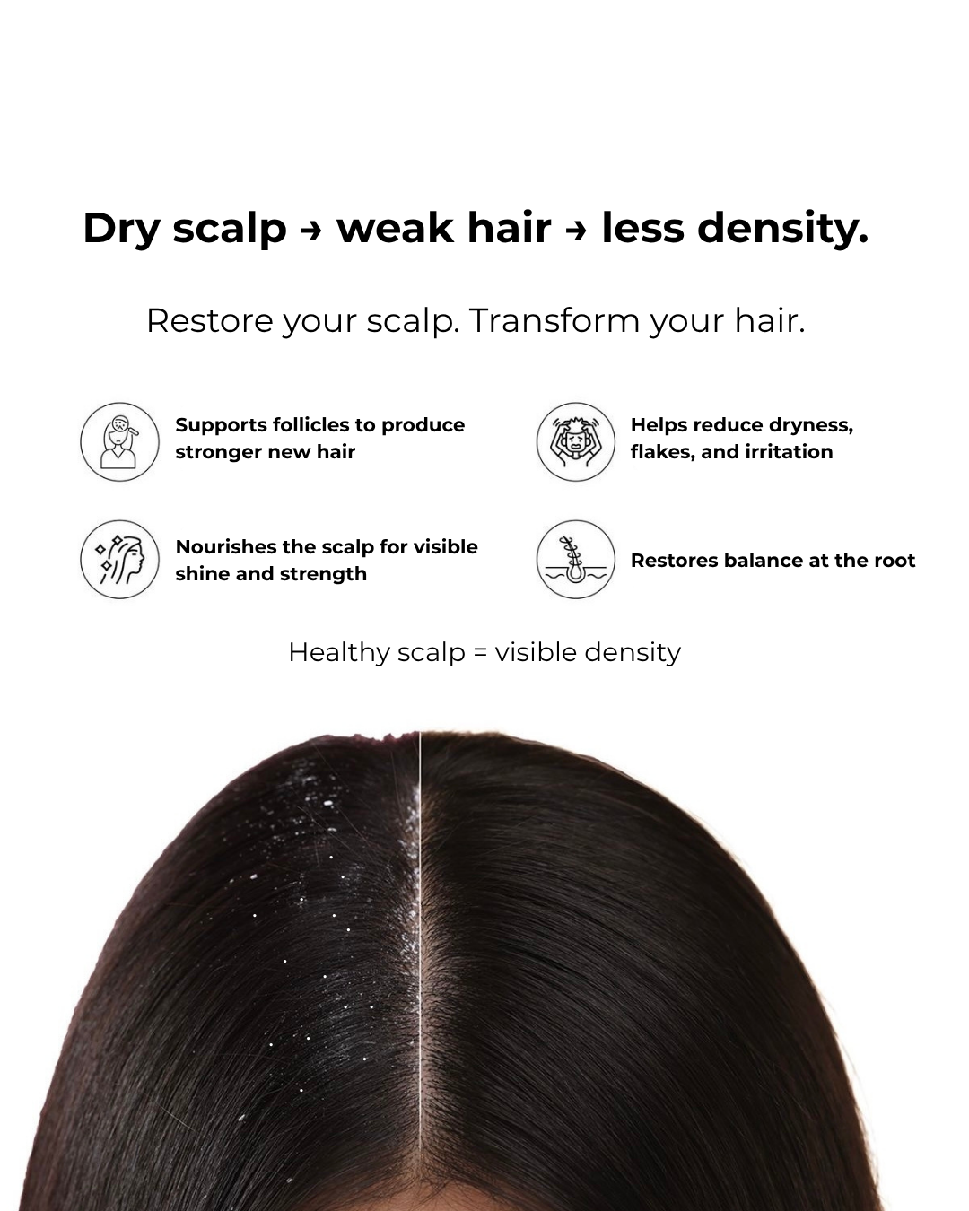 Rosemary & Ginger Scalp Oil