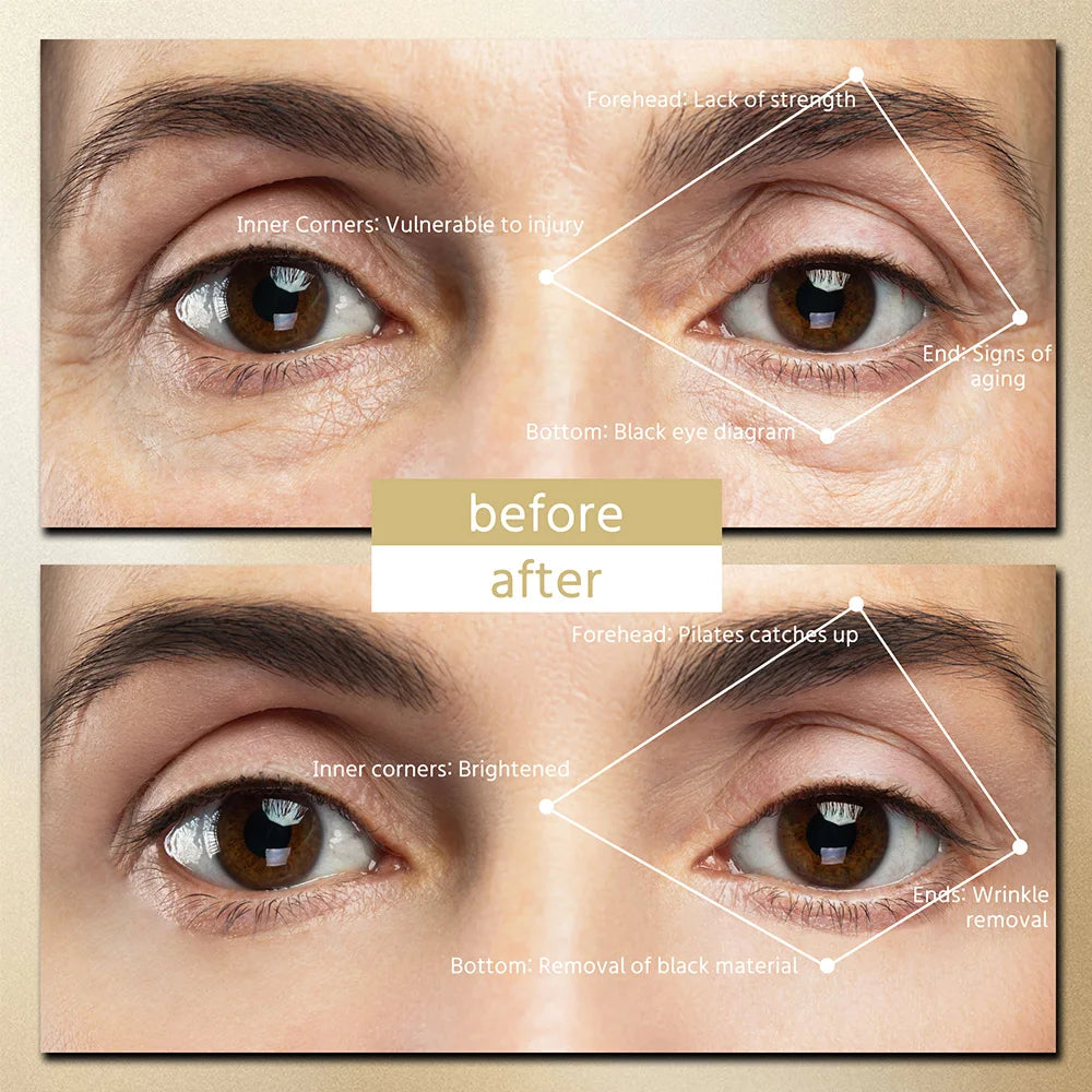 Microcurrent Eye Massager with Red Light Therapy – Eye Reviver