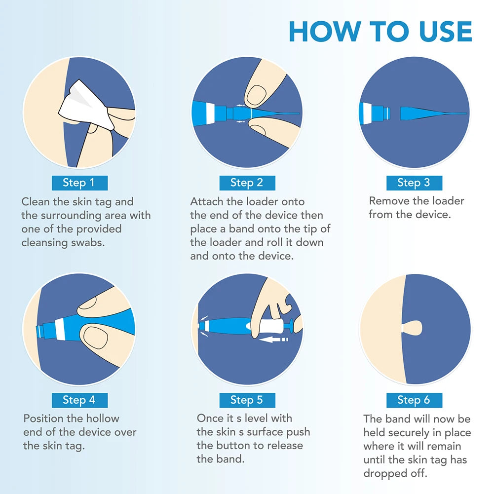 Auto Micro Skin Tag Remover – 2-in-1 Mole & Wart Removal Kit