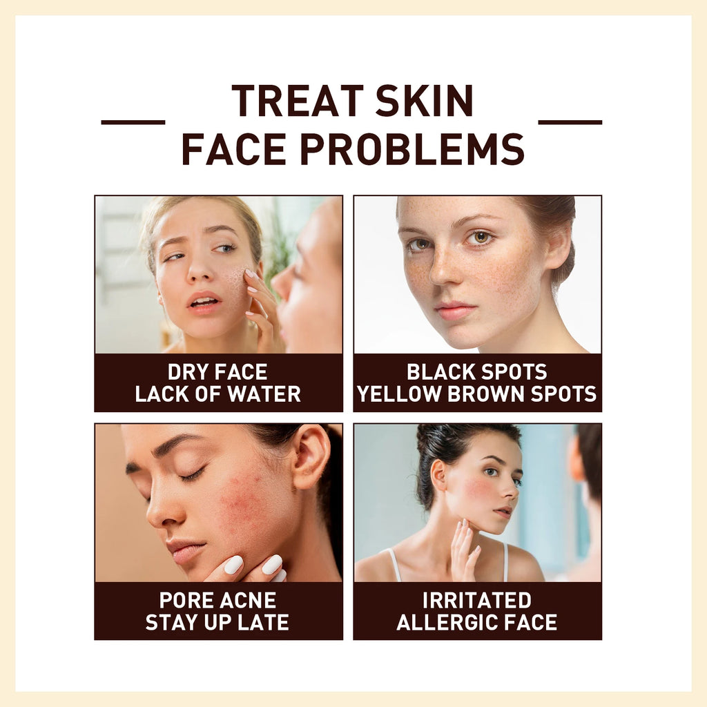 Rice Ferment Serum – Hydrating, Brightening & Anti-Aging Face Treatment