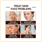 Rice Ferment Serum – Hydrating, Brightening & Anti-Aging Face Treatment