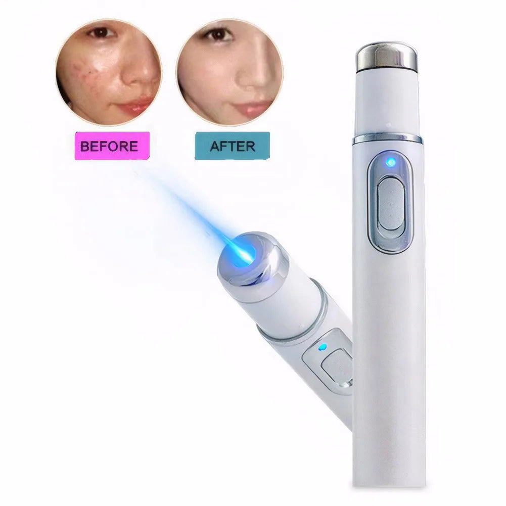 Blue Light Therapy Heated Eye Pen – Dark Circle & Puffiness Reducer