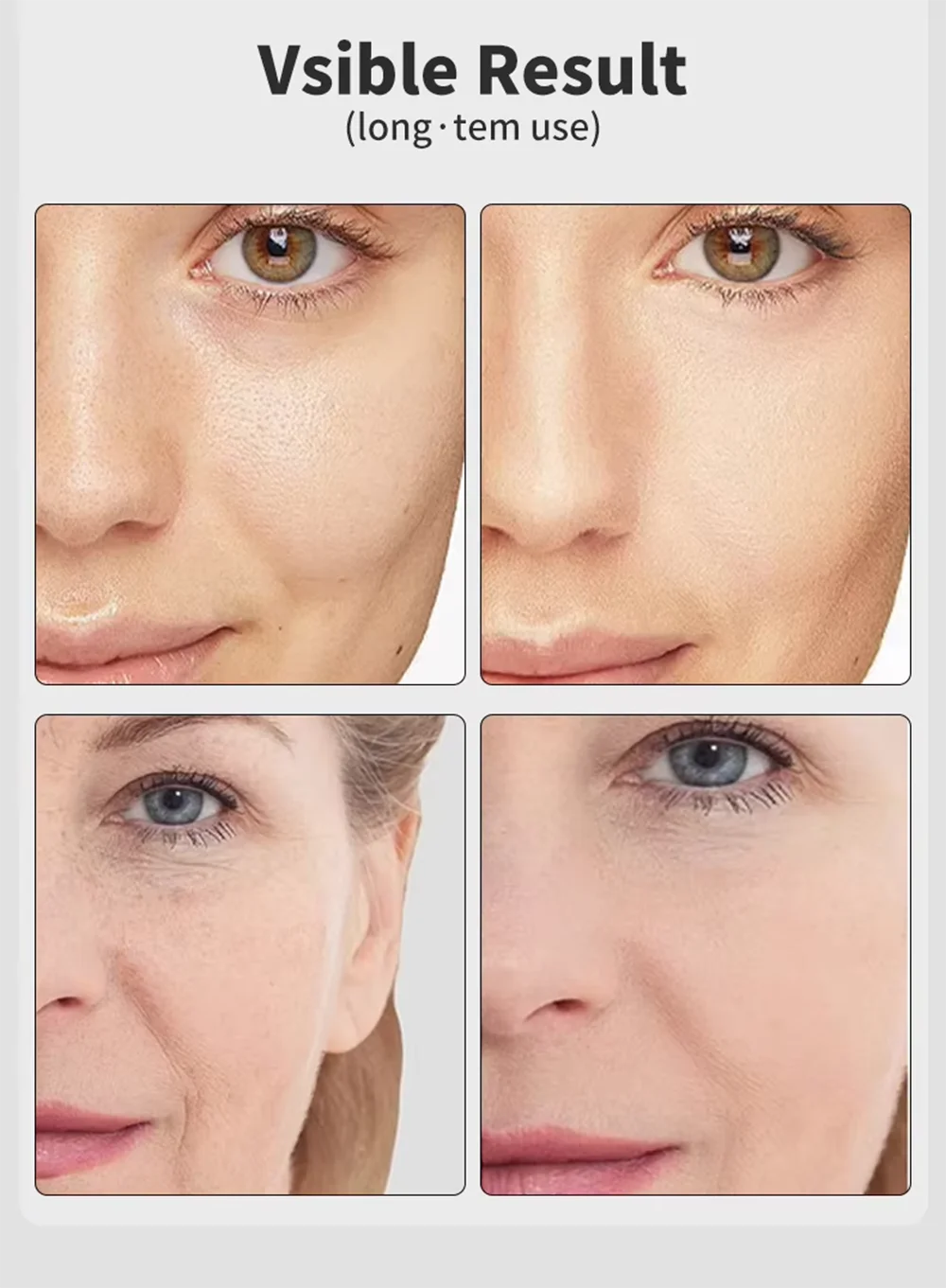 7-Color Age-R Booster Pro – EMS Facial Lift & Anti-Wrinkle Device