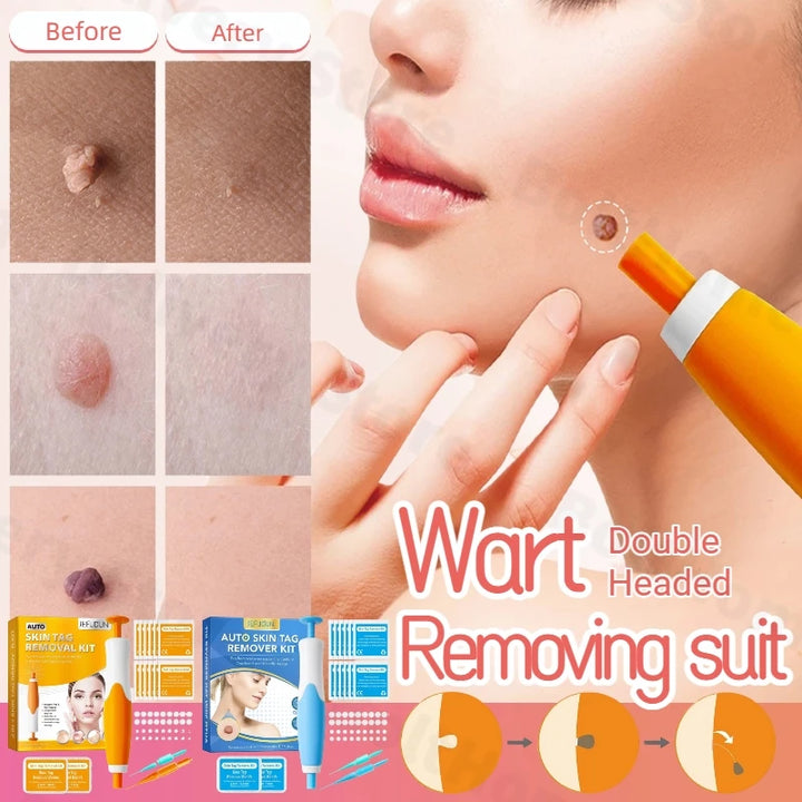 Auto Micro Skin Tag Remover – 2-in-1 Mole & Wart Removal Kit