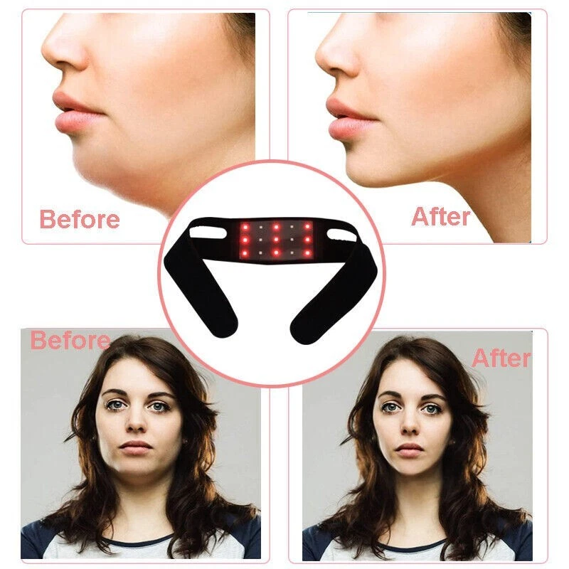LED Infrared Face Lift Belt – Chin Slimming & Jawline Shaping